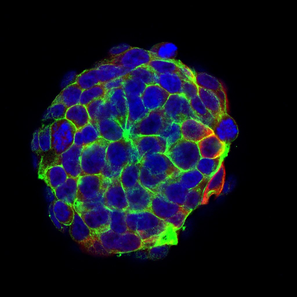 Prostate Spheroid