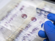 Dr Ban Kiwon’s team used rats’ hearts to carry out their research. These are the specimens of rats’ hearts.